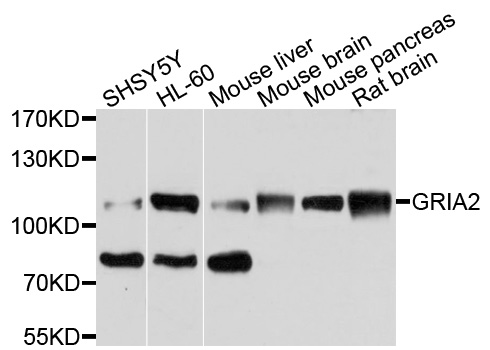 GRIA2 / GLUR2 Antibody - Western blot analysis of extracts of various cell lines, using GRIA2 antibody at 1:1000 dilution. The secondary antibody used was an HRP Goat Anti-Rabbit IgG (H+L) at 1:10000 dilution. Lysates were loaded 25ug per lane and 3% nonfat dry milk in TBST was used for blocking. An ECL Kit was used for detection and the exposure time was 10s.