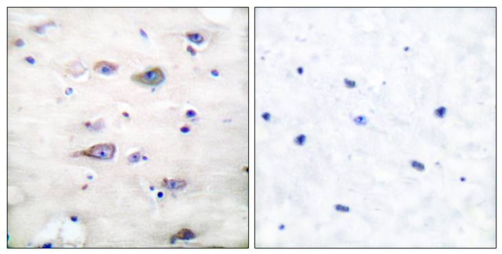 GRIA2 / GLUR2 Antibody - Immunohistochemistry analysis of paraffin-embedded human brain, using GluR2 (Phospho-Ser880) Antibody. The picture on the right is blocked with the phospho peptide.