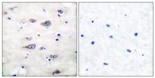 GRIA2 / GLUR2 Antibody - Immunohistochemistry analysis of paraffin-embedded human brain, using GluR2 (Phospho-Ser880) Antibody. The picture on the right is blocked with the phospho peptide.