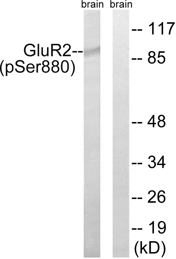 GRIA2 / GLUR2 Antibody - Western blot analysis of lysates from mouse brain, using GluR2 (Phospho-Ser880) Antibody. The lane on the right is blocked with the phospho peptide.