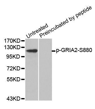 GRIA2 / GLUR2 Antibody - Western blot analysis of extracts from mouse brain tissue.