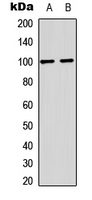 GRIA2 / GLUR2 Antibody - Western blot analysis of GLUR2 (pS880) expression in mouse brain (A); rat brain (B) whole cell lysates.