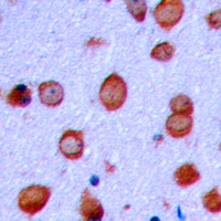 GRIA2 / GLUR2 Antibody - Immunohistochemical analysis of GLUR2 (pS880) staining in human brain formalin fixed paraffin embedded tissue section. The section was pre-treated using heat mediated antigen retrieval with sodium citrate buffer (pH 6.0). The section was then incubated with the antibody at room temperature and detected using an HRP conjugated compact polymer system. DAB was used as the chromogen. The section was then counterstained with hematoxylin and mounted with DPX.