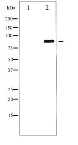 GRIA2 / GLUR2 Antibody - Western blot of GluR2 phosphorylation expression in Mouse brain tissue lysates,The lane on the left is treated with the antigen-specific peptide.