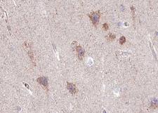 GRIA2 / GLUR2 Antibody - 1:100 staining human brain tissue by IHC-P. The tissue was formaldehyde fixed and a heat mediated antigen retrieval step in citrate buffer was performed. The tissue was then blocked and incubated with the antibody for 1.5 hours at 22°C. An HRP conjugated goat anti-rabbit antibody was used as the secondary.