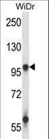 GRIA3 / GLUR3 Antibody - GRIA3 Antibody western blot of WiDr cell line lysates (35 ug/lane). The GRIA3 antibody detected the GRIA3 protein (arrow).