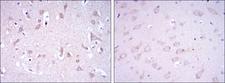 GRIA3 / GLUR3 Antibody - IHC of paraffin-embedded human brain tissues (left) and rat brain tissues (right) using GRIA3 mouse monoclonal antibody with DAB staining.