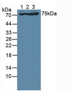 GRIA3 / GLUR3 Antibody - Western Blot; Sample: Lane1: Human U-87MG Cells; Lane2: Porcine Brain Tissue; Lane3: Mouse Brain Tissue.