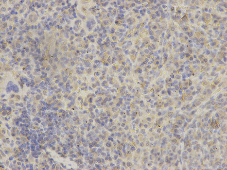 GRIA3 / GLUR3 Antibody - Immunohistochemistry of paraffin-embedded rat spleen using GRIA3 antibody at dilution of 1:200 (400x lens).