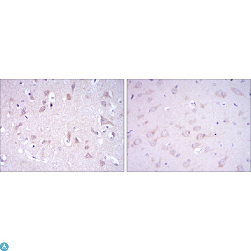 GRIA3 / GLUR3 Antibody - Immunohistochemistry (IHC) analysis of paraffin-embedded Human Brain tissues (left) and Rat Brain tissues (right) with DAB staining using GluR-3 Monoclonal Antibody.