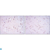 GRIA3 / GLUR3 Antibody - Immunohistochemistry (IHC) analysis of paraffin-embedded Human Brain tissues (left) and Rat Brain tissues (right) with DAB staining using GluR-3 Monoclonal Antibody.