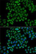 GRIA3 / GLUR3 Antibody - Immunofluorescence analysis of HeLa cells using GRIA3 Polyclonal Antibody.