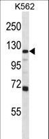 GRIA4 / GLUR4 Antibody - GRIA4 Antibody western blot of K562 cell line lysates (35 ug/lane). The GRIA4 antibody detected the GRIA4 protein (arrow).