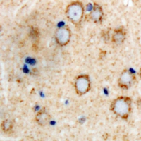GRIA4 / GLUR4 Antibody - Immunohistochemical analysis of GLUR4 staining in human brain formalin fixed paraffin embedded tissue section. The section was pre-treated using heat mediated antigen retrieval with sodium citrate buffer (pH 6.0). The section was then incubated with the antibody at room temperature and detected using an HRP polymer system. DAB was used as the chromogen. The section was then counterstained with hematoxylin and mounted with DPX.