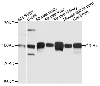 GRIA4 / GLUR4 Antibody - Western blot analysis of extracts of various cell lines, using GRIA4 antibody at 1:1000 dilution. The secondary antibody used was an HRP Goat Anti-Rabbit IgG (H+L) at 1:10000 dilution. Lysates were loaded 25ug per lane and 3% nonfat dry milk in TBST was used for blocking. An ECL Kit was used for detection and the exposure time was 5s.
