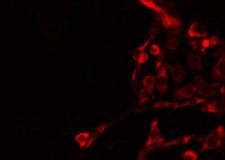 GRIA4 / GLUR4 Antibody - Staining HepG2 cells by IF/ICC. The samples were fixed with PFA and permeabilized in 0.1% Triton X-100, then blocked in 10% serum for 45 min at 25°C. The primary antibody was diluted at 1:200 and incubated with the sample for 1 hour at 37°C. An Alexa Fluor 594 conjugated goat anti-rabbit IgG (H+L) Ab, diluted at 1/600, was used as the secondary antibody.