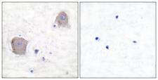GRIA4 / GLUR4 Antibody - Peptide - + Immunohistochemical analysis of paraffin-embedded human brain tissue using GluR4 antibody.