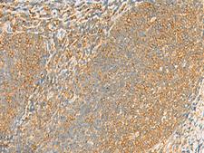 GRIA4 / GLUR4 Antibody - Immunohistochemistry of paraffin-embedded Human tonsil tissue  using GRIA4 Polyclonal Antibody at dilution of 1:60(×200)