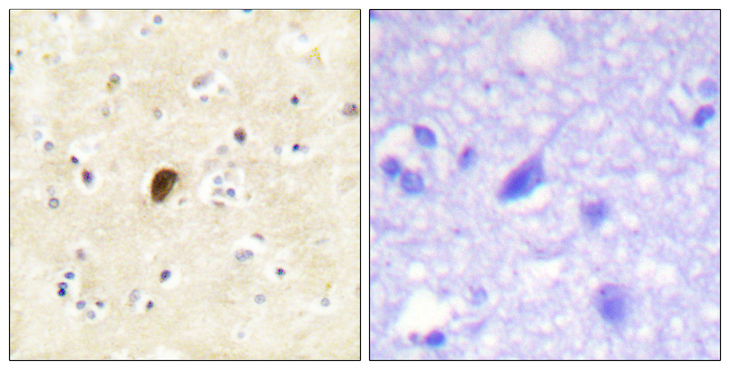 GRIA4 / GLUR4 Antibody - Immunohistochemistry analysis of paraffin-embedded human brain, using GluR4 (Phospho-Ser862) Antibody. The picture on the right is blocked with the phospho peptide.
