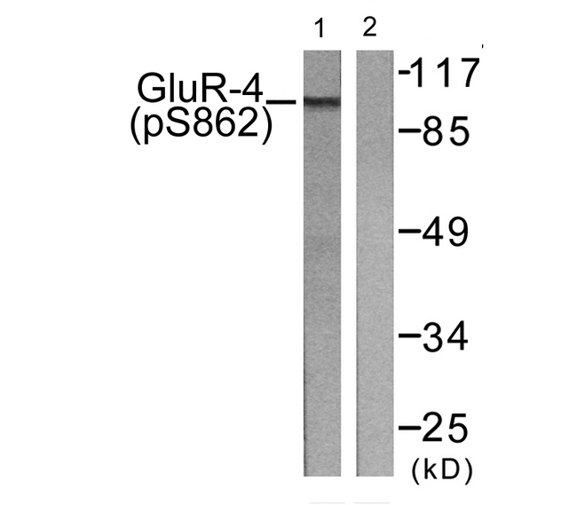 GRIA4 / GLUR4 Antibody - Western blot analysis of lysates from HepG2 cells treated with Forskolin 40nM 30', using GluR4 (Phospho-Ser862) Antibody. The lane on the right is blocked with the phospho peptide.