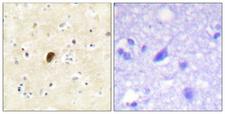 GRIA4 / GLUR4 Antibody - P-peptide - + Immunohistochemistry analysis of paraffin-embedded human brain tissue using GluR4 (Phospho-Ser862) antibody.