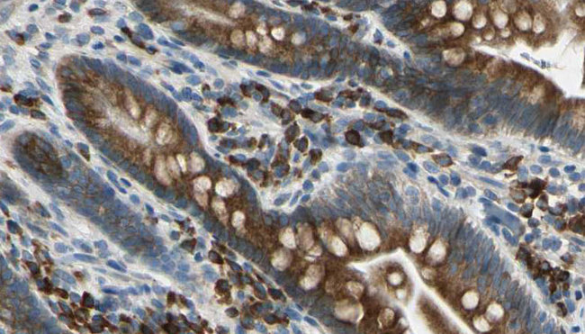 GRID1 Antibody - 1:100 staining mouse intestine tissue by IHC-P. The sample was formaldehyde fixed and a heat mediated antigen retrieval step in citrate buffer was performed. The sample was then blocked and incubated with the antibody for 1.5 hours at 22°C. An HRP conjugated goat anti-rabbit antibody was used as the secondary.