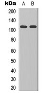 GRID2 Antibody - Western blot analysis of GLURD2 expression in HEK293T (A); mouse brain (B) whole cell lysates.
