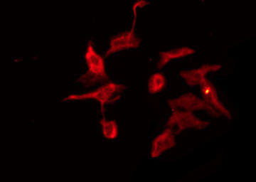 GRID2 Antibody - Staining NIH-3T3 cells by IF/ICC. The samples were fixed with PFA and permeabilized in 0.1% Triton X-100, then blocked in 10% serum for 45 min at 25°C. The primary antibody was diluted at 1:200 and incubated with the sample for 1 hour at 37°C. An Alexa Fluor 594 conjugated goat anti-rabbit IgG (H+L) Ab, diluted at 1/600, was used as the secondary antibody.