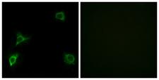 GRID2 Antibody - Peptide - + Immunofluorescence analysis of HuvEc cells, using GRID2 antibody.