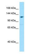 GRID2IP Antibody - GRID2IP antibody Western Blot of HepG2.  This image was taken for the unconjugated form of this product. Other forms have not been tested.