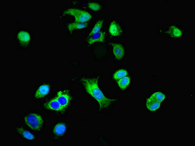 GRID2IP Antibody - Immunofluorescent analysis of MCF-7 cells diluted at 1:100 and Alexa Fluor 488-congugated AffiniPure Goat Anti-Rabbit IgG(H+L)
