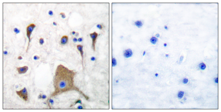 GRIK1 / GLUR5 Antibody - Immunohistochemistry analysis of paraffin-embedded human brain tissue, using GluR5 Antibody. The picture on the right is blocked with the synthesized peptide.