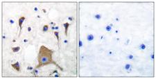 GRIK1 / GLUR5 Antibody - Immunohistochemistry analysis of paraffin-embedded human brain tissue, using GluR5 Antibody. The picture on the right is blocked with the synthesized peptide.