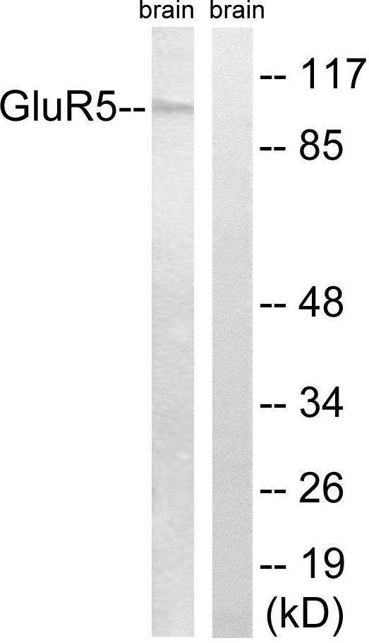 GRIK1 / GLUR5 Antibody - Western blot analysis of lysates from mouse brain, using GluR5 Antibody. The lane on the right is blocked with the synthesized peptide.