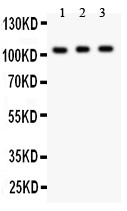 GRIK1 / GLUR5 Antibody - GRIK1 antibody Western blot. All lanes: Anti GRIK1 at 0.5 ug/ml. Lane 1: Mouse Brain Tissue Lysate at 50 ug. Lane 2: Mouse Brain Tissue Lysate at 50 ug. Lane 3: SHG Whole Cell Lysate at 40 ug. Predicted band size: 104 kD. Observed band size: 104 kD.