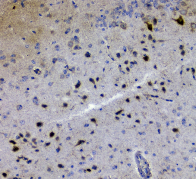 GRIK1 / GLUR5 Antibody - IHC analysis of GRIK1 using anti-GRIK1 antibody. GRIK1 was detected in paraffin-embedded section of mouse brain tissue tissues. Heat mediated antigen retrieval was performed in citrate buffer (pH6, epitope retrieval solution) for 20 mins. The tissue section was blocked with 10% goat serum. The tissue section was then incubated with 1µg/ml rabbit anti-GRIK1 Antibody overnight at 4°C. Biotinylated goat anti-rabbit IgG was used as secondary antibody and incubated for 30 minutes at 37°C. The tissue section was developed using Strepavidin-Biotin-Complex (SABC) with DAB as the chromogen.