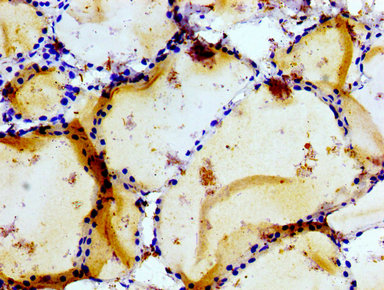 GRIK1 / GLUR5 Antibody - Immunohistochemistry image of paraffin-embedded human thyroid tissue at a dilution of 1:100