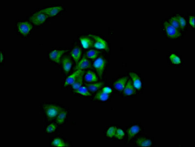 GRIK1 / GLUR5 Antibody - Immunofluorescence staining of Hela cells with GRIK1 Antibody at 1:100, counter-stained with DAPI. The cells were fixed in 4% formaldehyde, permeabilized using 0.2% Triton X-100 and blocked in 10% normal Goat Serum. The cells were then incubated with the antibody overnight at 4°C. The secondary antibody was Alexa Fluor 488-congugated AffiniPure Goat Anti-Rabbit IgG(H+L).