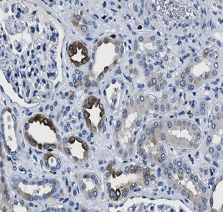 GRIK1 / GLUR5 Antibody - 1:100 staining human kidney tissue by IHC-P. The tissue was formaldehyde fixed and a heat mediated antigen retrieval step in citrate buffer was performed. The tissue was then blocked and incubated with the antibody for 1.5 hours at 22°C. An HRP conjugated goat anti-rabbit antibody was used as the secondary.