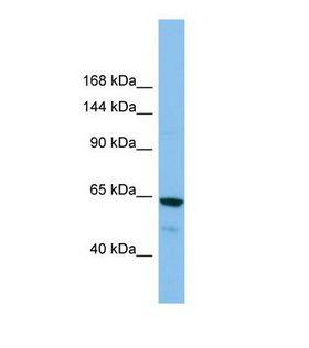 GRIK2 / GLUR6 Antibody - Western blot of Human ACHN. GRIK2 antibody dilution 1.0 ug/ml.  This image was taken for the unconjugated form of this product. Other forms have not been tested.