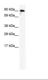 GRIK2 / GLUR6 Antibody - Fetal Brain Lysate.  This image was taken for the unconjugated form of this product. Other forms have not been tested.