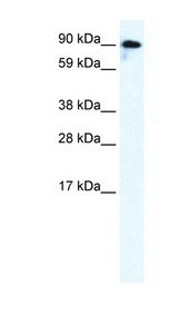GRIK2 / GLUR6 Antibody - GRIK2 antibody Western blot of Fetal brain lysate. This image was taken for the unconjugated form of this product. Other forms have not been tested.