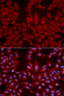 GRIK2 / GLUR6 Antibody - Immunofluorescence analysis of U2OS cells.