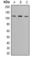 GRIK2 / GLUR6 Antibody - Western blot analysis of GLUR6 expression in SW620 (A); A549 (B); mouse brain (C) whole cell lysates.