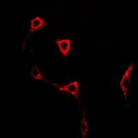 GRIK2 / GLUR6 Antibody - Immunofluorescent analysis of GLUR6 staining in U2OS cells. Formalin-fixed cells were permeabilized with 0.1% Triton X-100 in TBS for 5-10 minutes and blocked with 3% BSA-PBS for 30 minutes at room temperature. Cells were probed with the primary antibody in 3% BSA-PBS and incubated overnight at 4 deg C in a humidified chamber. Cells were washed with PBST and incubated with a DyLight 594-conjugated secondary antibody (red) in PBS at room temperature in the dark.
