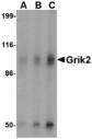 GRIK2 / GLUR6 Antibody - Western blot of Grik2 in human brain tissue lysate with Grik2 antibody at (A) 0.5 and (B) 1 ug/ml.