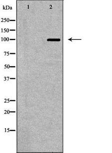 GRIK2 / GLUR6 Antibody - Western blot analysis of mouse brain lysate using GRIK2 antibody. The lane on the left is treated with the antigen-specific peptide.