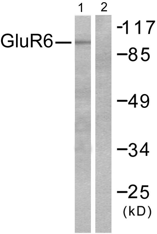 GRIK2 / GLUR6 Antibody - Western blot analysis of extracts from mouse brain, using GluR6 antibody.