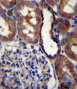 GRIK3 / GLUR7 Antibody - GRIK3 Antibody immunohistochemistry of formalin-fixed and paraffin-embedded human kidney tissue followed by peroxidase-conjugated secondary antibody and DAB staining.