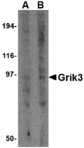 GRIK3 / GLUR7 Antibody - Western blot of Grik3 in human brain tissue lysate with Grik3 antibody at (A) 1 and (B) 2 ug/ml.